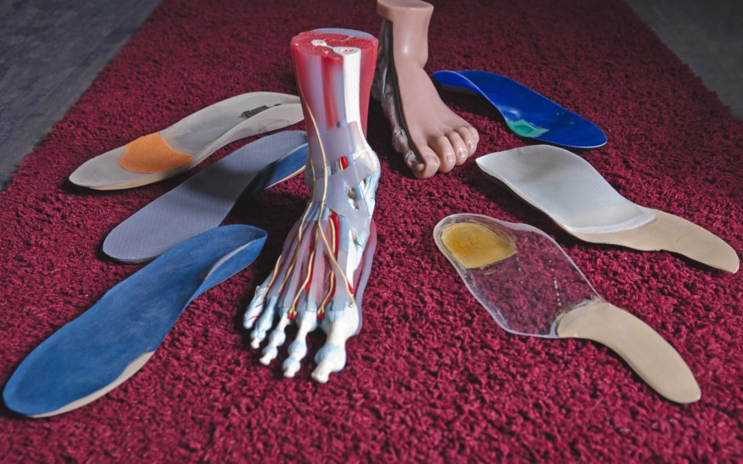 Ortesi plantare e scarpe, il giusto rapporto.